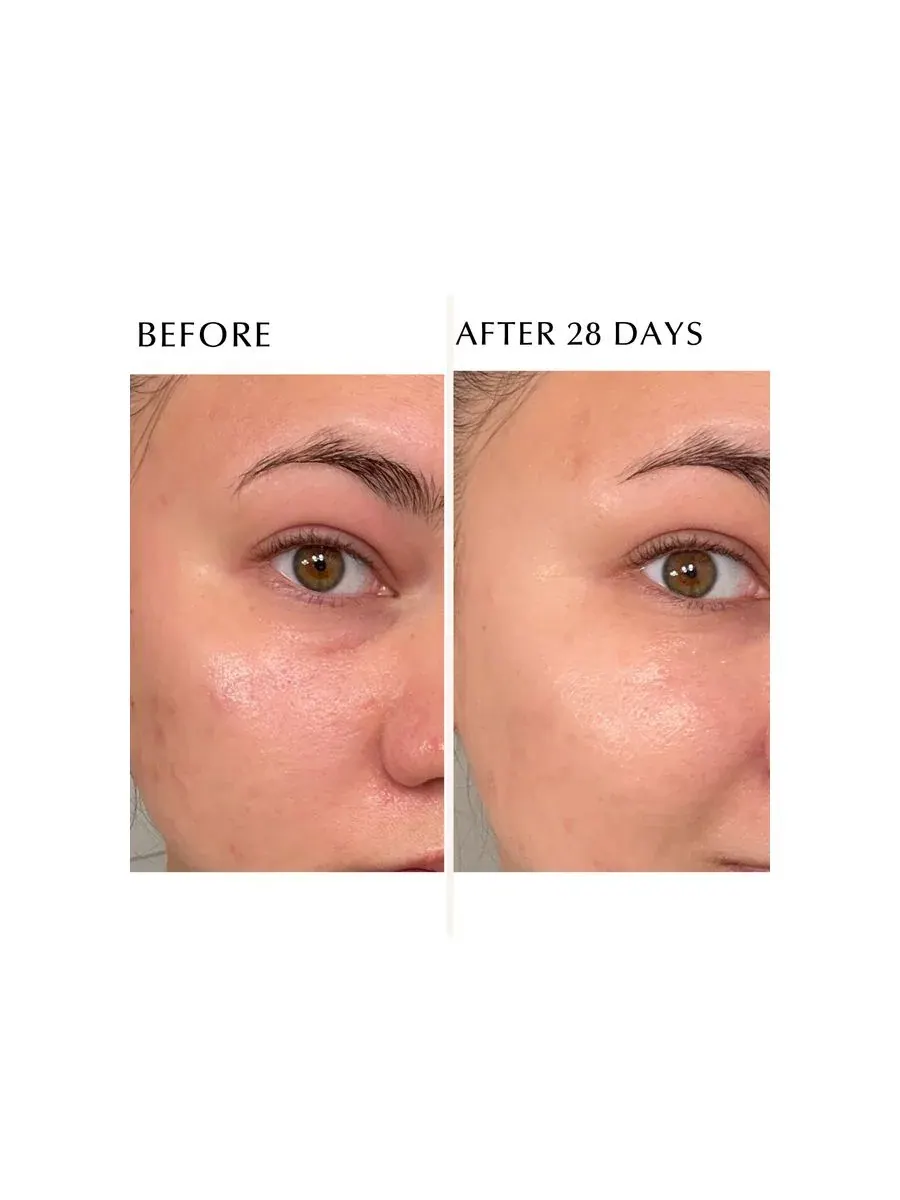 Сыворотка Albion — Осветляющая Excia Immaculate Serum Z , X, 1.5 мл — изображение 6 из 6