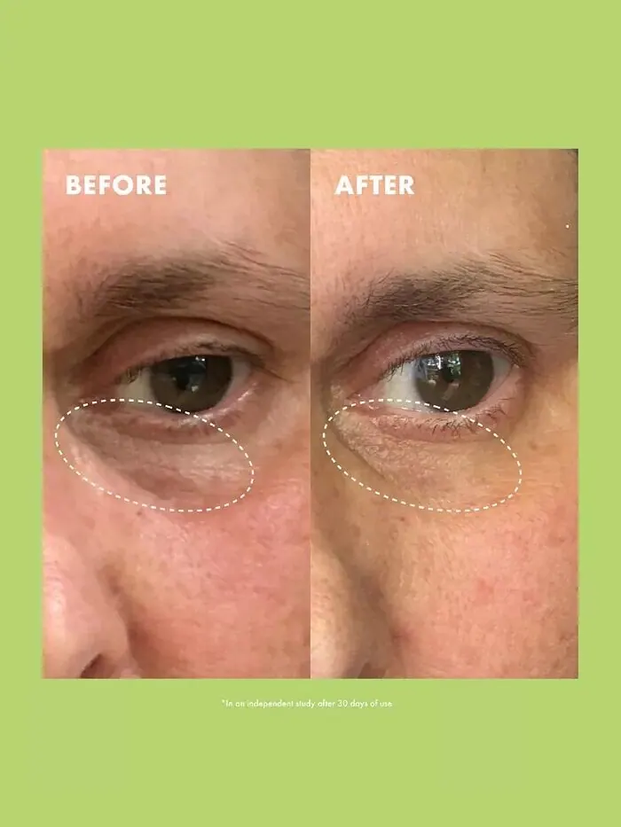 Крем для век с ниацинамидом и кофеином Kopari Beauty — изображение 4 из 8