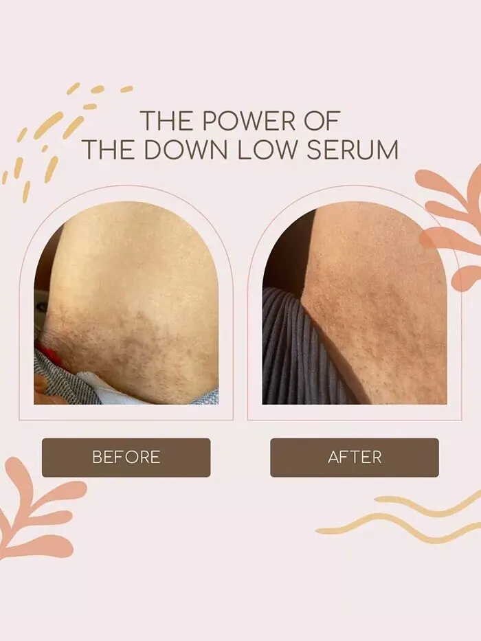 The Down Low Сыворотка для внутренней поверхности бедра Forgotten Skincare — изображение 5 из 5