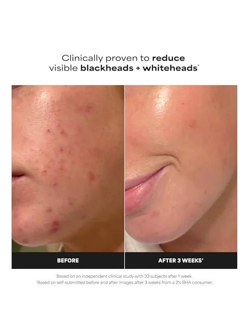 Paula's Choice SKIN PERFECTING 2% BHA — эксфолиант — 2