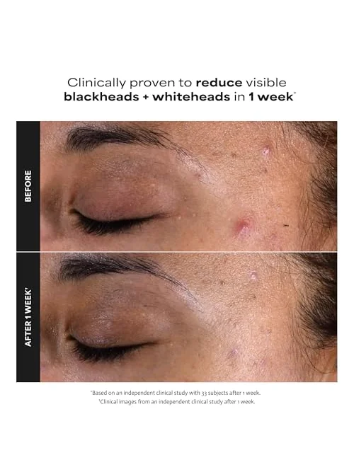 Paula's Choice SKIN PERFECTING 2% BHA — эксфолиант — 4