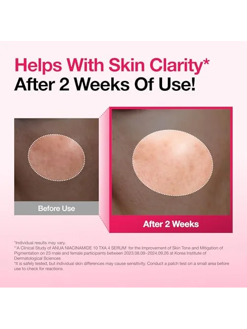 Anua сыворотка Niacinamide 10 + TXA 4 для лица — 5