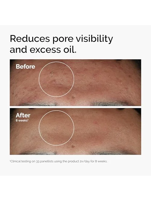The Ordinary Niacinamide 10% + Zinc — сыворотка — 2