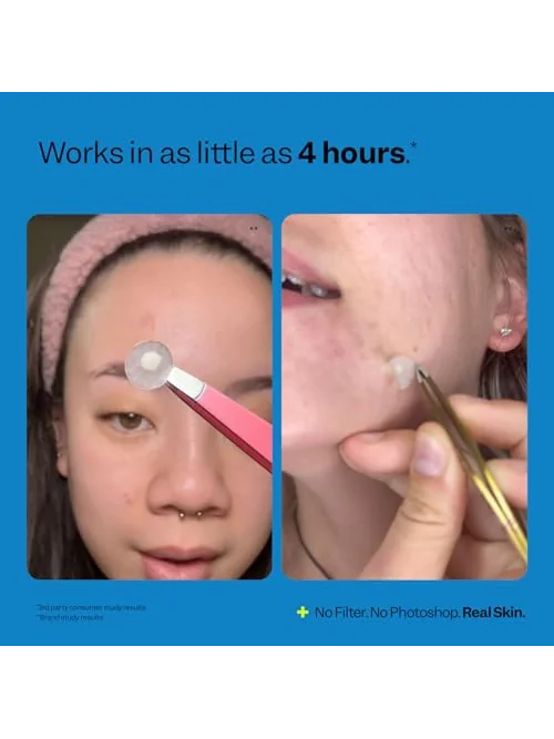 Peach Slices — пластыри от прыщей, 30 шт. — изображение 6 из 6
