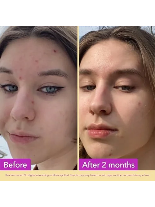 Good Molecules сыворотка с ниацинамидом 10% — 3