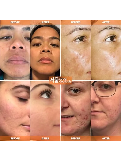SeoulCeuticals витамин C сыворотка (30 мл) — 3