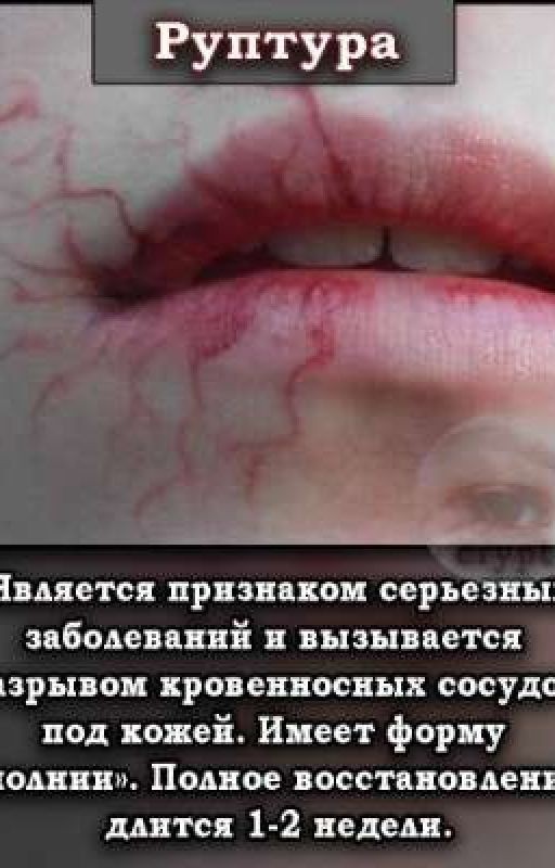 My Жизнь