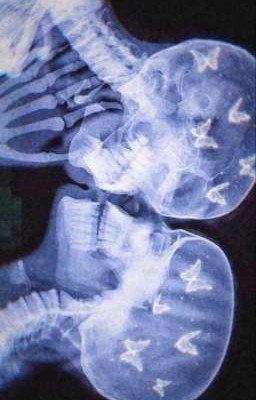 замершие 🔞