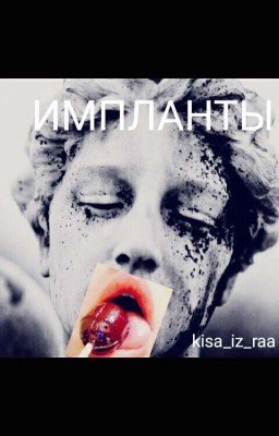Импланты