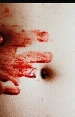 Суецидница