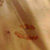 kisslers