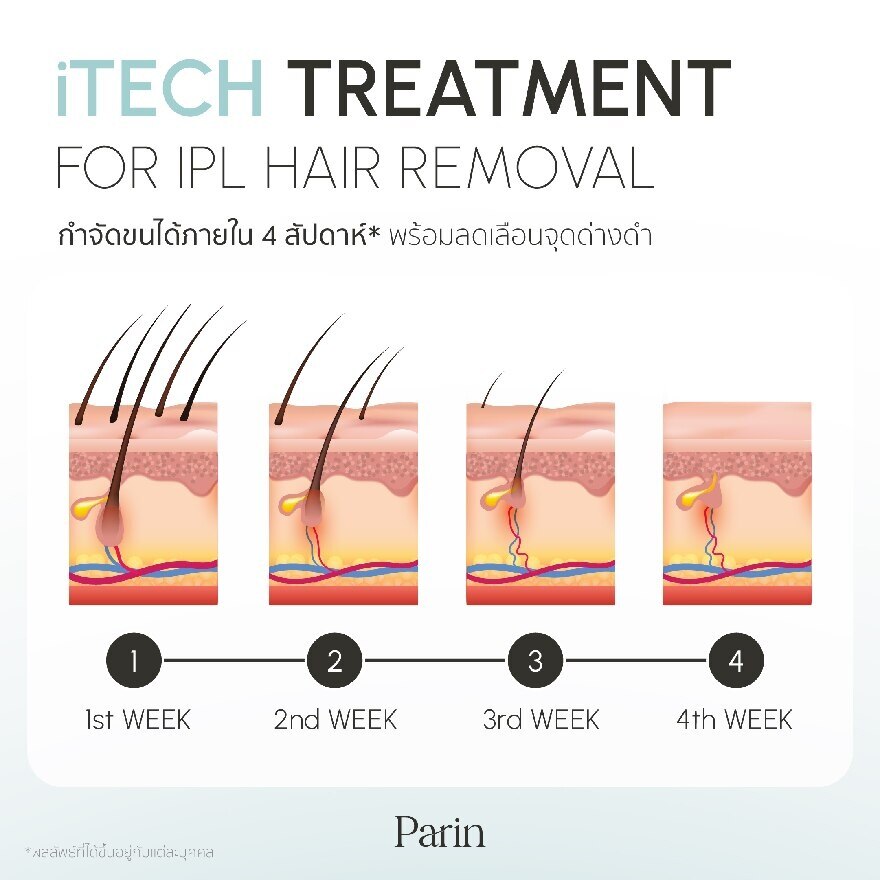 Parin IPL Iconic Gen4 White Pearl 1pcs.