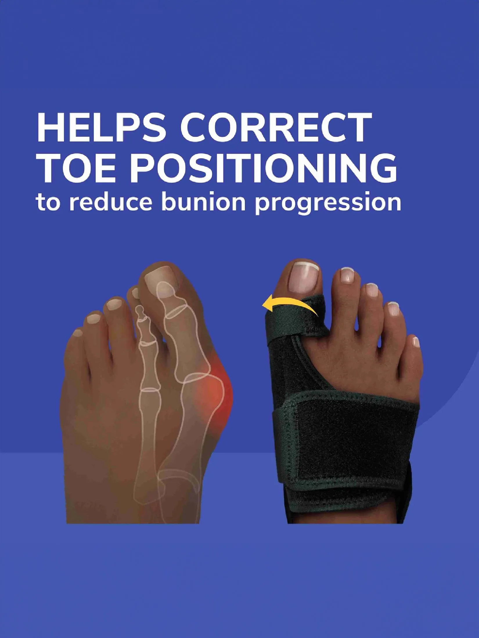 SCHOLL Dr.Scholl's Bunion Relief and Toe Corrector Massaging Gel Splint