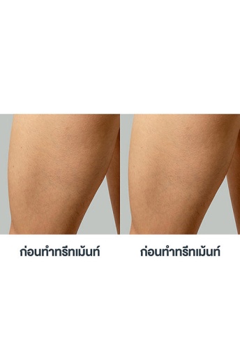 Hair Removal Device Peach 2 Peach - 100% оригинал фото 9