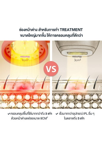 Hair Removal Device Peach 2 Mint - 100% оригинал фото 6