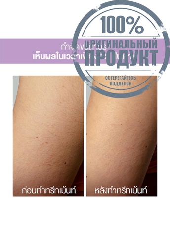 Hair Removal Device Peach 2 Go Lavender - 100% оригинал фото 7 Hair Removal Device Peach 2 Go Lavender - 100% оригинал фото 7