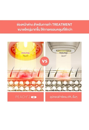 Hair Removal Device Peach 2 Go Peach - 100% оригинал фото 5