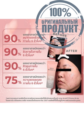 3D Power Acne Clear Gel 12 mL - 100% оригинал фото 9 3D Power Acne Clear Gel 12 mL - 100% оригинал фото 9