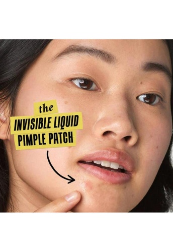 Blemish-Clearing Solution 15 mL - 100% оригинал фото 6