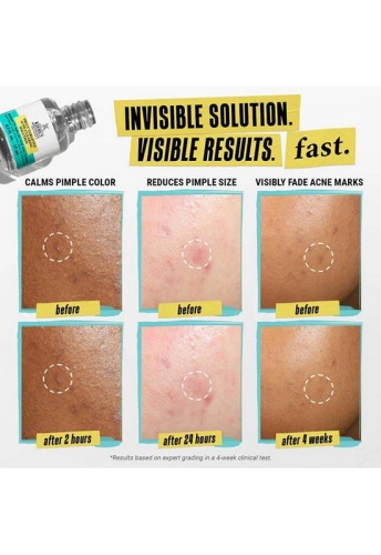 Blemish-Clearing Solution 15 mL - 100% оригинал фото 7