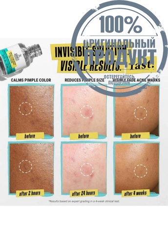 Blemish-Clearing Solution 15 mL - 100% оригинал фото 7 Blemish-Clearing Solution 15 mL - 100% оригинал фото 7