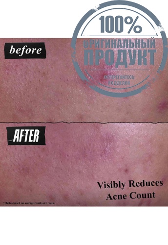 Gently Effective Blemish-Targeting Cleansing Paste 125 mL - 100% оригинал фото 4 Gently Effective Blemish-Targeting Cleansing Paste 125 mL - 100% оригинал фото 4