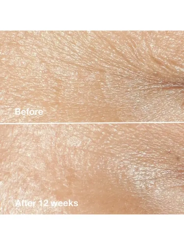 SMART CLN REP WKL CRT CRM 50ML - 100% оригинал фото 2